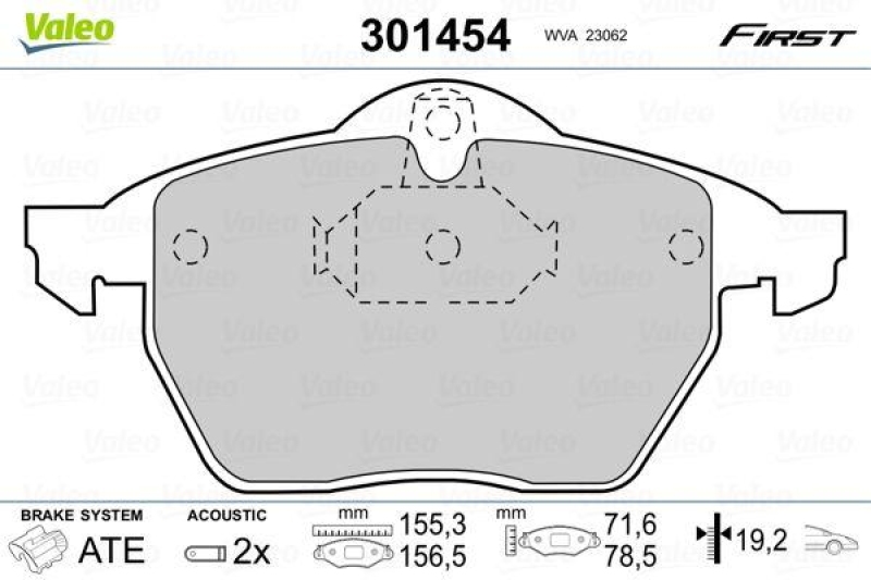 VALEO 301454 SBB-Satz FIRST