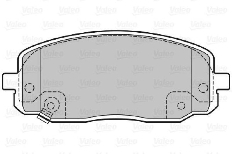 VALEO 598707 SBB-Satz PREMIUM