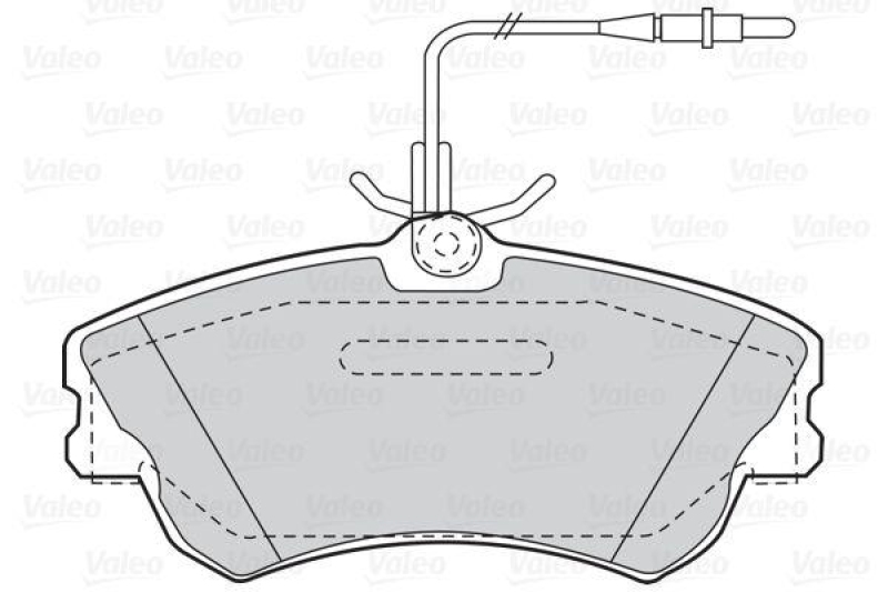 VALEO 302217 SBB-Satz FIRST